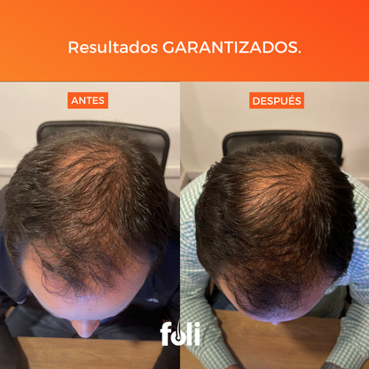 foli™️ | Crecimiento de Cabello | 90 días